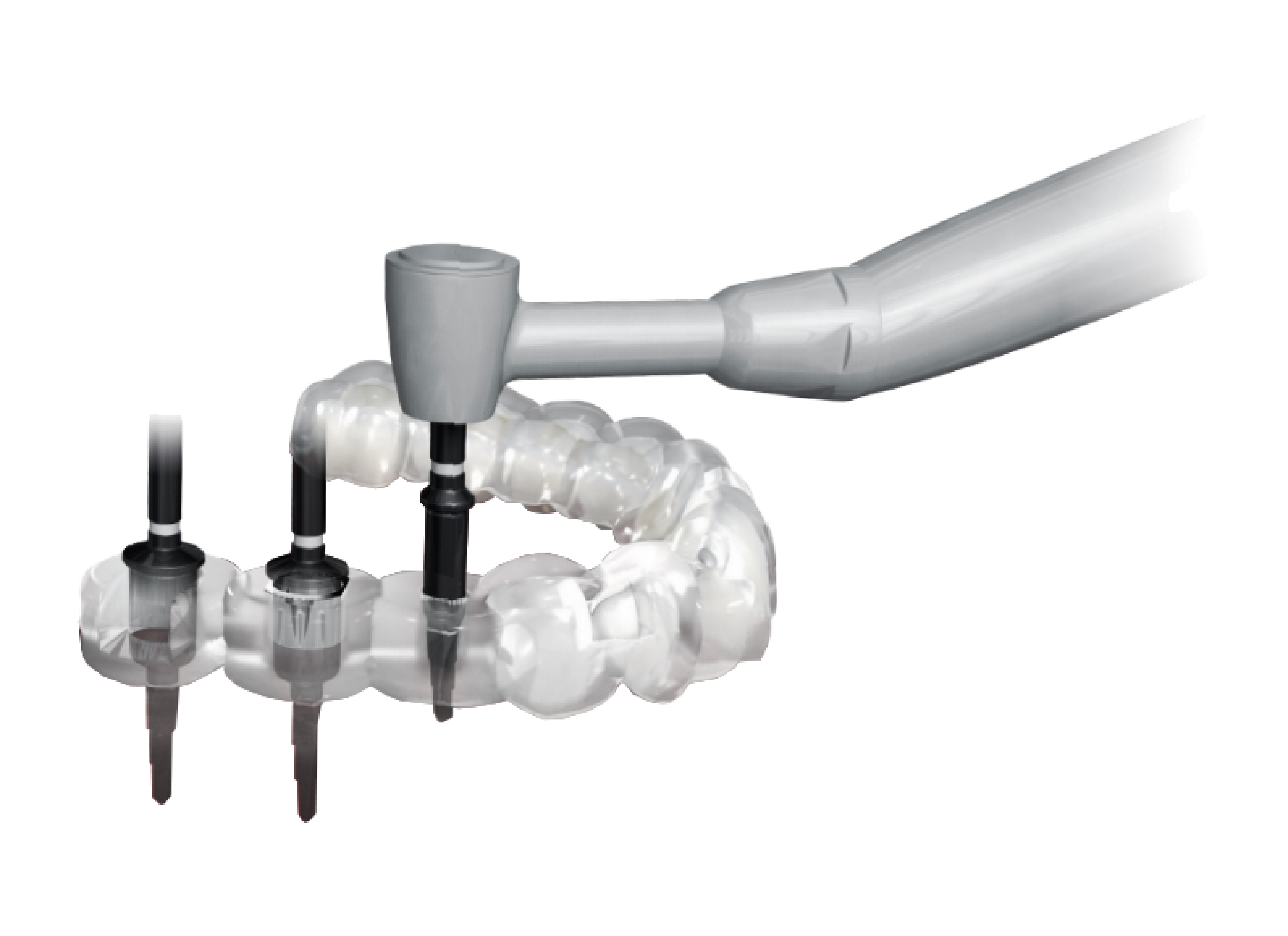 Surgical Guide by Minimax Implant